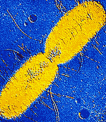 Bacterium dividing
