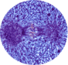 Metaphase under magnification