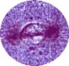 Prophase under magnification